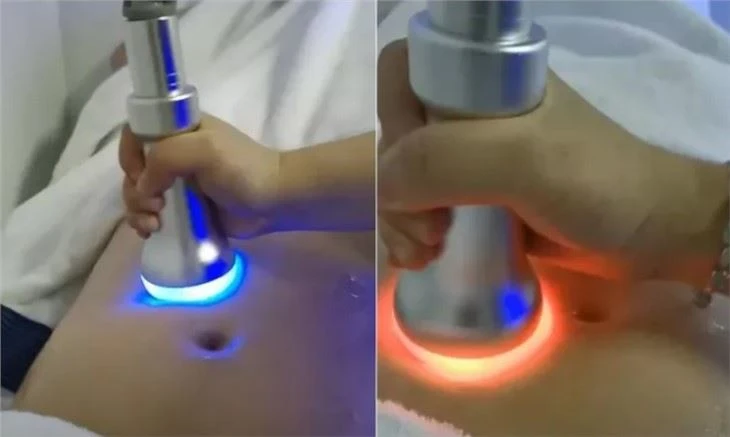 Unique Advantages Of America's Best Selling Cryoskin Machine
