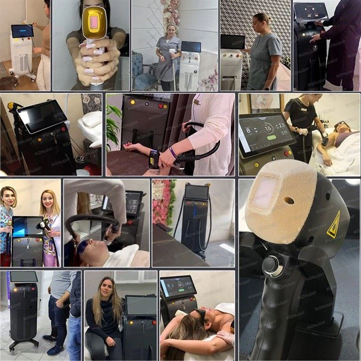 Diode Laser Hair Removal Machine Good Reviews