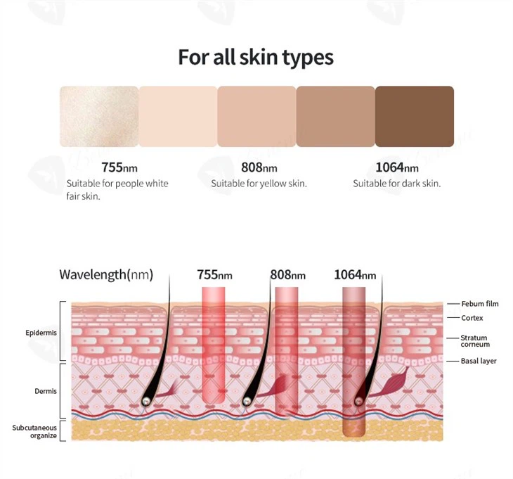 Soprano Titanium Ice Laser Hair Removal Machine