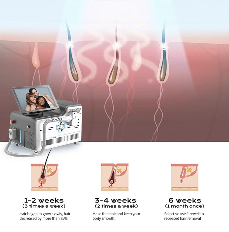 Professional Portable Diode Laser Hair Removal Machine