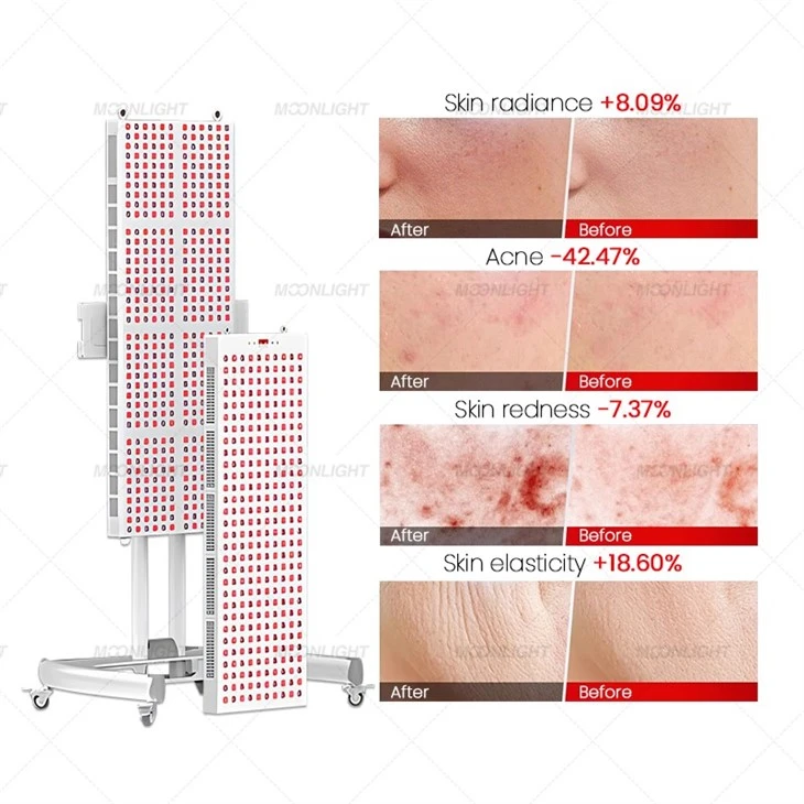 Red Light Therapy Panel