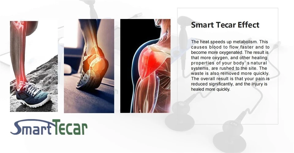 Smart Tecar Physical Therapy Machine